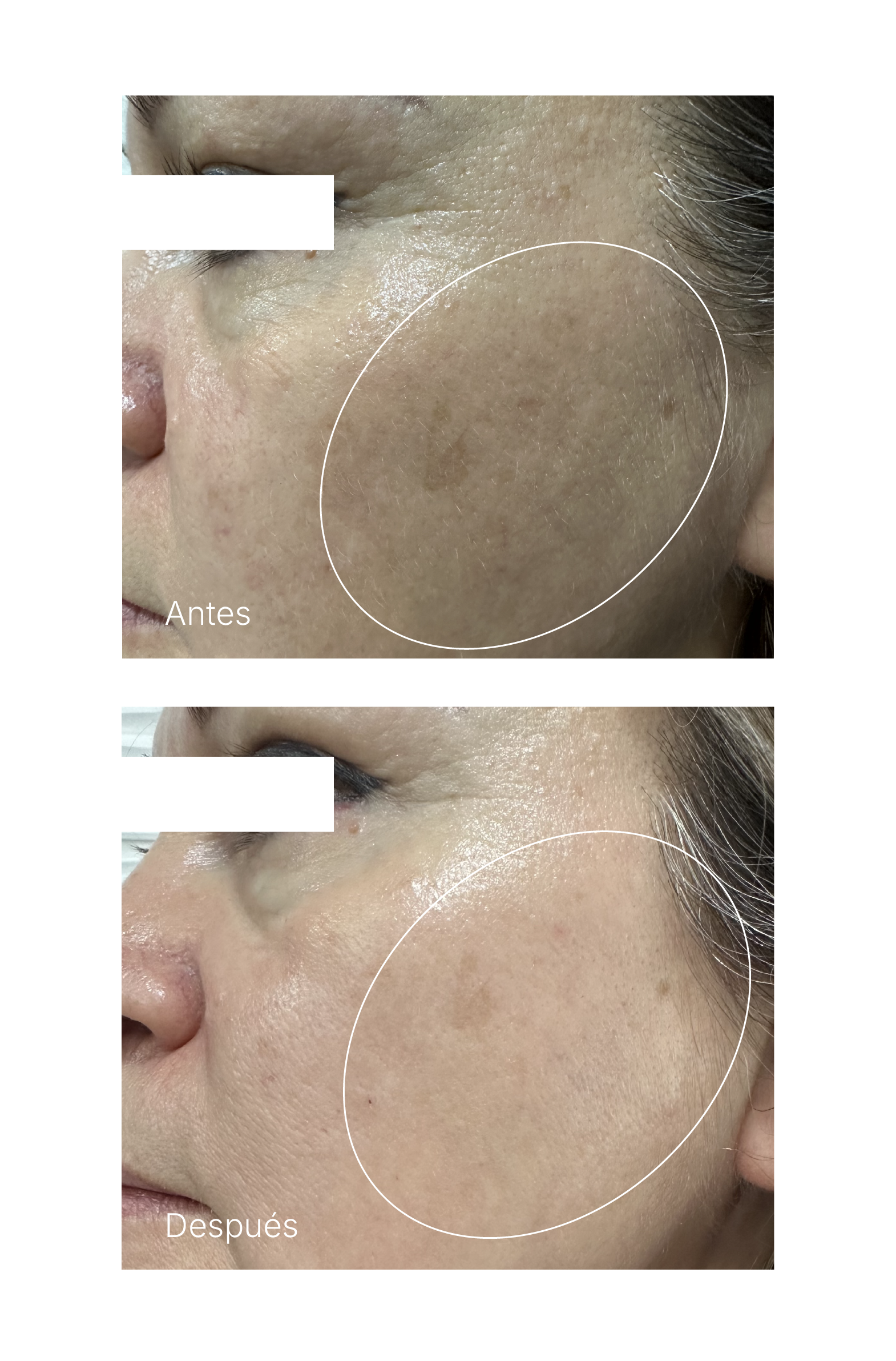 SUERO OH MY! SPOTLESS