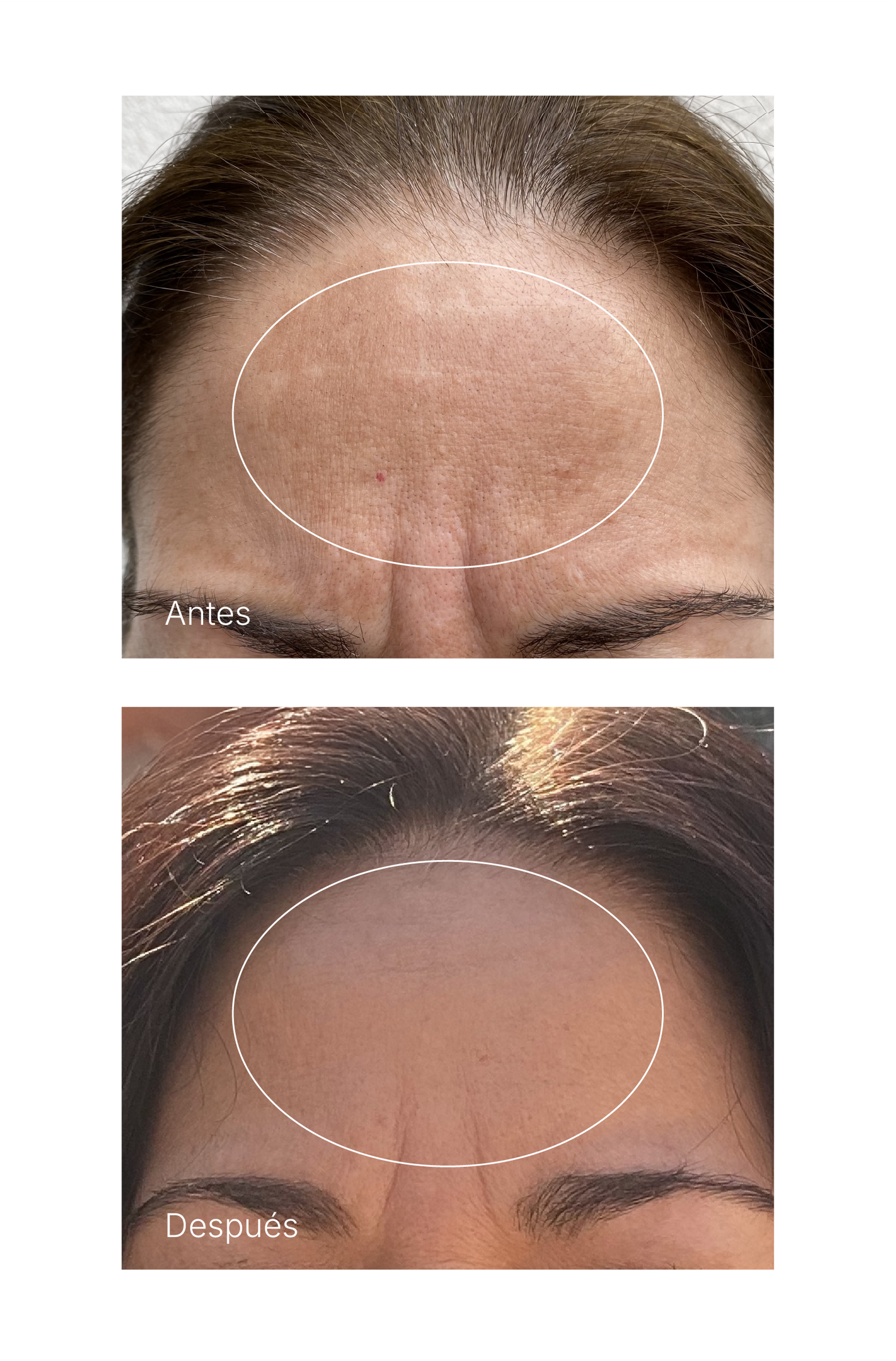 SUERO OH MY! SPOTLESS